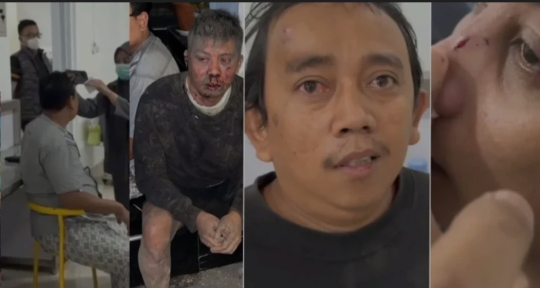 Anggota Buser Rentcar Nasional Dianiaya Komplotan Ormas di Pasuruan Jawa